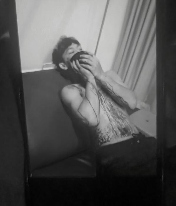 Diserang Saat Menjaga Arus Lalu Lintas, Pemuda Ciparay Jadi Korban Kebrutalan OTK