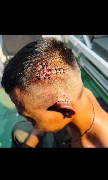 Duel Preman di Cileunyi Diduga Berebut Lahan Parkir, Korban Alami Luka di Kepala dan Leher